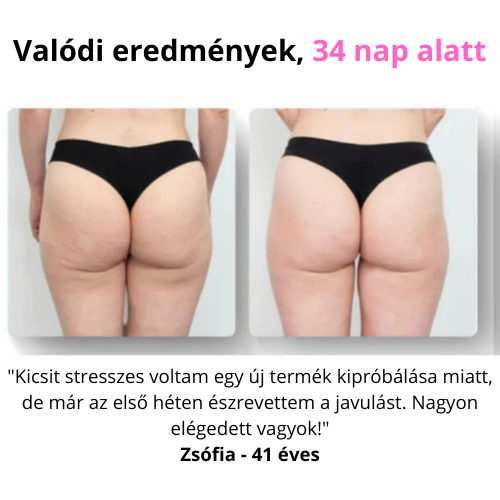 CelluStop - Anticellulit Masszírozó