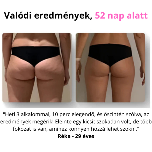CelluStop - Anticellulit Masszírozó